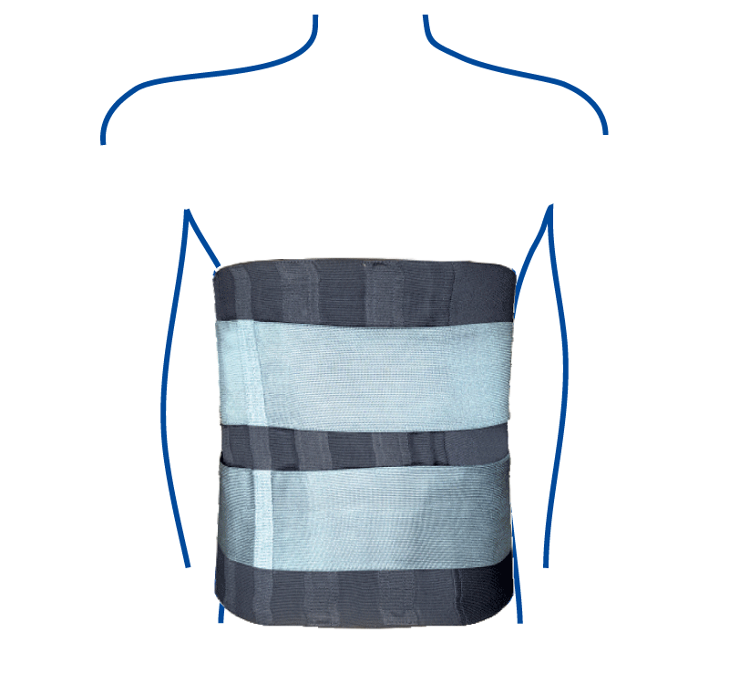 Elastic transverse-crest ridge orthosis (corset)